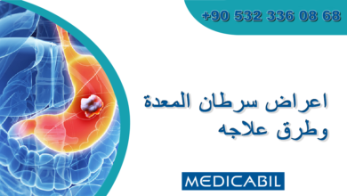 أسباب سرطان المعدة
