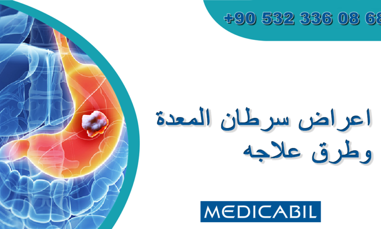 أسباب سرطان المعدة